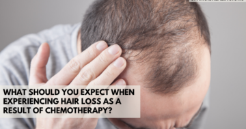 when hair loss chemotherapy